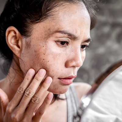 Decoding Pigmentation: Why You Have It When Others Don't.